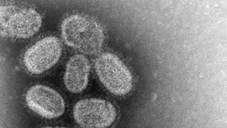 The U.S. Will Stop Funding Research into Making Mutant Super Viruses